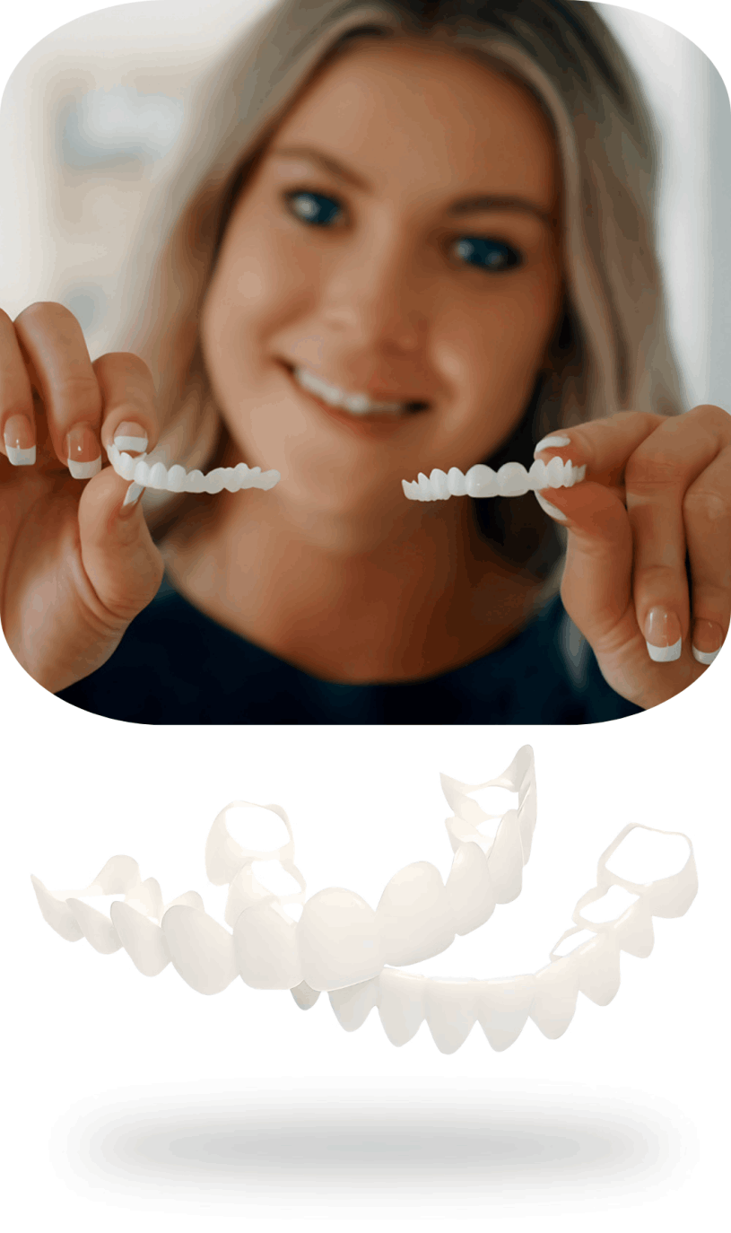 Shiny Smile Veneers 11